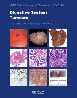 Nádory tráviacej sústavy: Kto klasifikuje nádory - Digestive System Tumours: Who Classification of Tumours