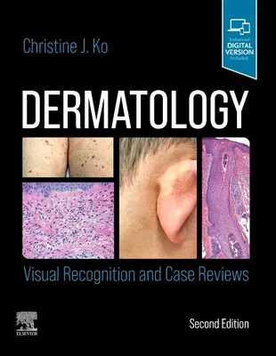 Dermatológia: Vizuálne rozpoznávanie a recenzie prípadov - Dermatology: Visual Recognition and Case Reviews