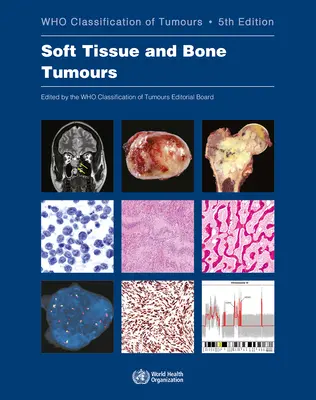 Nádory mäkkých tkanív a kostí: Kto klasifikuje nádory - Soft Tissue and Bone Tumours: Who Classification of Tumours