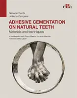 Adhezívna cementácia na prirodzených zuboch - Materiály a techniky - Adhesive cementation on natural teeth - Materials and techniques