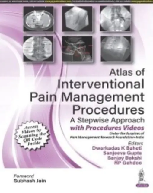 Atlas intervenčných postupov liečby bolesti - Atlas of Interventional Pain Management Procedures