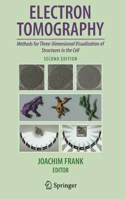 Elektrónová tomografia: Metódy trojrozmernej vizualizácie štruktúr v bunke - Electron Tomography: Methods for Three-Dimensional Visualization of Structures in the Cell