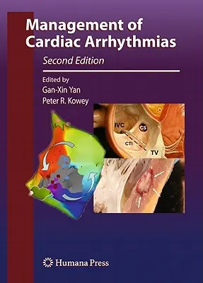 Manažment srdcových arytmií - Management of Cardiac Arrhythmias