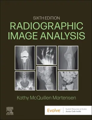 Rádiografická analýza obrazu - Radiographic Image Analysis