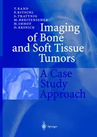 Zobrazovanie nádorov kostí a mäkkých tkanív: Prístup na základe prípadovej štúdie - Imaging of Bone and Soft Tissue Tumors: A Case Study Approach