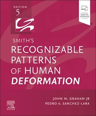 Smithove rozpoznateľné vzory deformácií človeka - Smith's Recognizable Patterns of Human Deformation