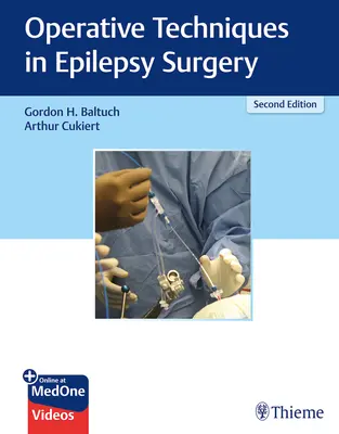 Operačné techniky v chirurgii epilepsie - Operative Techniques in Epilepsy Surgery