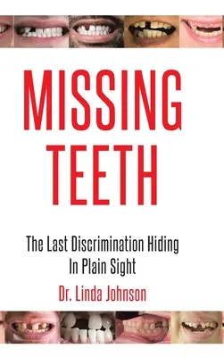 Chýbajúce zuby: Posledná diskriminácia, ktorá sa skrýva na prvý pohľad - Missing Teeth: The Last Discrimination Hiding in Plain Sight