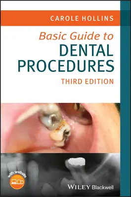 Základný sprievodca zubnými postupmi - Basic Guide to Dental Procedures