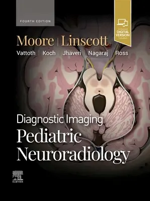 Diagnostické zobrazovanie: Pediatrická neurorádiológia - Diagnostic Imaging: Pediatric Neuroradiology