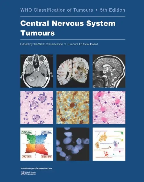 Nádory centrálneho nervového systému: Klasifikácia nádorov - Central Nervous System Tumours: Who Classification of Tumours