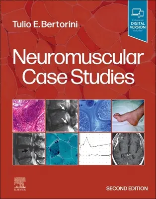 Neuromuskulárne prípadové štúdie - Neuromuscular Case Studies