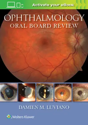 Oftalmologická ústna skúška - Ophthalmology Oral Board Review