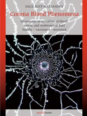 Fenomén koronálnej krvi: Mikroskopické vyšetrenia krvi, séra a mozgovomiechového moku: Zdravý - očkovaný - zotavený - Corona Blood Phenomena: Microscopic Examinations of Blood, Serum, and Cerebrospinal Fluid: Healthy - Vaccinated - Recovered