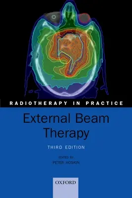 Terapia vonkajším lúčom - External Beam Therapy