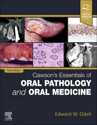 Cawsonove základy ústnej patológie a ústnej medicíny - Cawson's Essentials of Oral Pathology and Oral Medicine