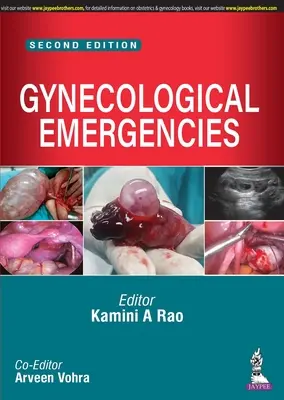 Núdzové gynekologické situácie - Gynecological Emergencies