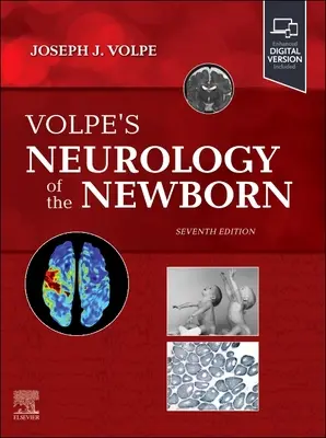 Volpeho neurológia novorodenca - Volpe's Neurology of the Newborn