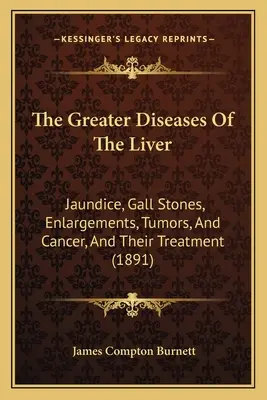 Väčšie choroby pečene: Žltačka, žlčové kamene, zväčšenia, nádory a rakovina a ich liečba - The Greater Diseases Of The Liver: Jaundice, Gall Stones, Enlargements, Tumors, And Cancer, And Their Treatment