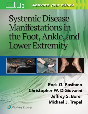 Prejavy systémových ochorení na nohe, členku a dolnej končatine - Systemic Disease Manifestations in the Foot, Ankle, and Lower Extremity