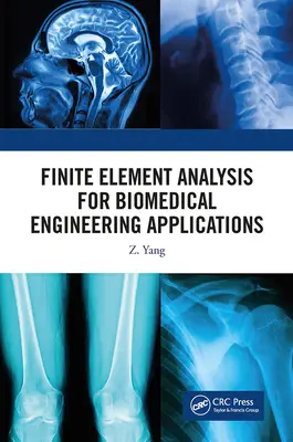 Analýza metódou konečných prvkov pre aplikácie v biomedicínskom inžinierstve - Finite Element Analysis for Biomedical Engineering Applications
