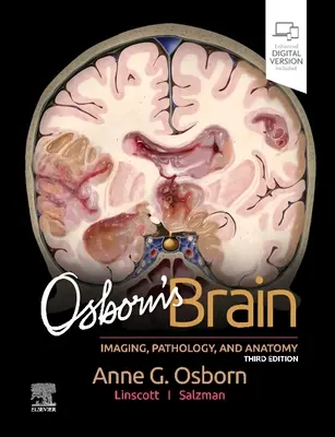 Osbornov mozog - Osborn's Brain