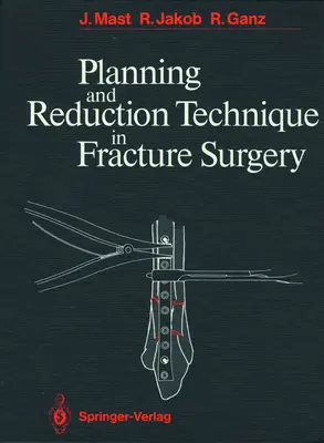 Plánovanie a redukčná technika v chirurgii zlomenín - Planning and Reduction Technique in Fracture Surgery