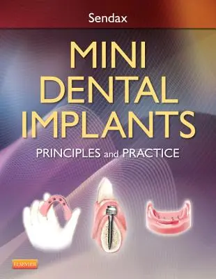 Mini zubné implantáty: Princípy a prax - Mini Dental Implants: Principles and Practice