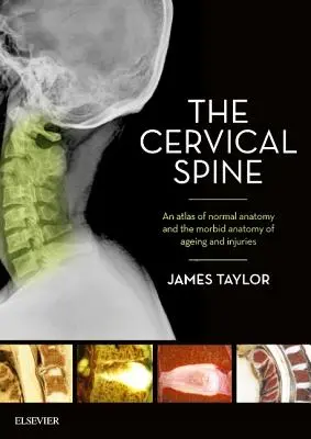The Cervical Spine: Atlas normálnej anatómie a morbídnej anatómie starnutia a úrazov - The Cervical Spine: An Atlas of Normal Anatomy and the Morbid Anatomy of Ageing and Injuries