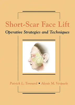 Krátka úprava tváre: Operatívne stratégie a techniky - Short-Scar Face Lift: Operative Strategies and Techniques