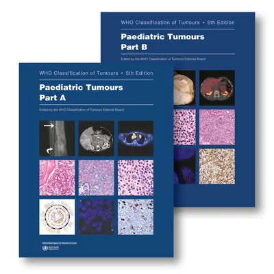 Detské nádory: Kto klasifikuje nádory - Paediatric Tumours: Who Classification of Tumours
