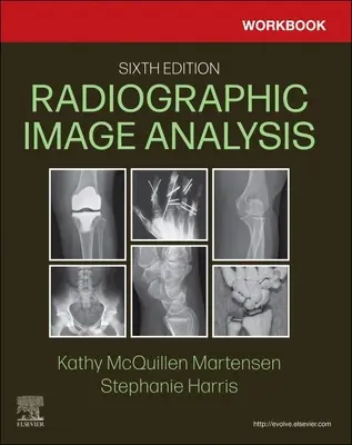 Pracovný zošit pre analýzu rádiografických snímok - Workbook for Radiographic Image Analysis