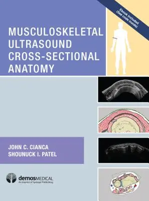 Prierezová anatómia muskuloskeletálneho ultrazvuku - Musculoskeletal Ultrasound Cross-Sectional Anatomy