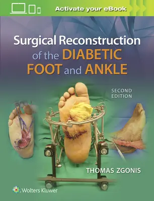 Chirurgická rekonštrukcia diabetickej nohy a členka - Surgical Reconstruction of the Diabetic Foot and Ankle