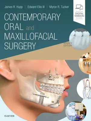 Súčasná ústna a čeľustná chirurgia - Contemporary Oral and Maxillofacial Surgery
