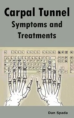 Príznaky karpálneho tunela a liečba: Príčiny syndrómu karpálneho tunela, diagnostika, príznaky, znaky, nechirurgická a chirurgická liečba, alt - Carpal Tunnel Symptoms and Treatments: All about Carpal Tunnel Syndrome Causes, Diagnosing, Symptoms, Signs, Non-Surgical and Surgical Treatments, Alt
