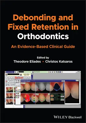 Debonding a fixná retencia v ortodoncii: Klinická príručka založená na dôkazoch - Debonding and Fixed Retention in Orthodontics: An Evidence-Based Clinical Guide